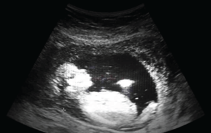 IIT Madras researchers develop new technique to provide high resolution ultrasound images