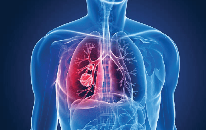 Trichy students develop smart chair for Chronic Obstructive Pulmonary Disease COPD patients